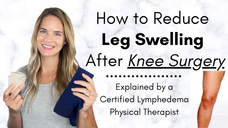 When to Worry About Swelling After Knee Surgery | Actualizado marzo 2024
